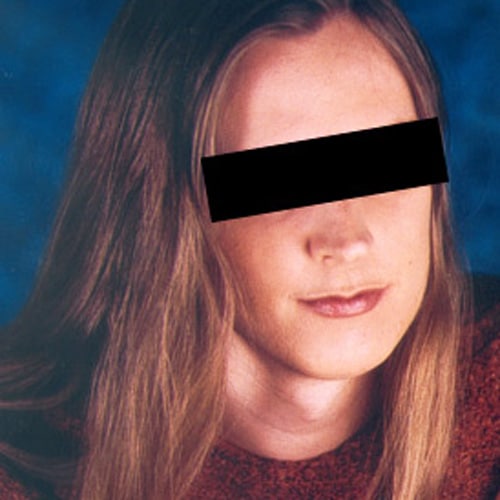 EpilationbartBeispiel_Trans Epilationspraxis Reuther & Feix