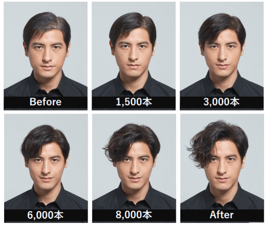 「アデランス×スパイバー」が “ホンモノ” の髪を商品化か？2021年、増毛・かつらはついに新時代へ突入