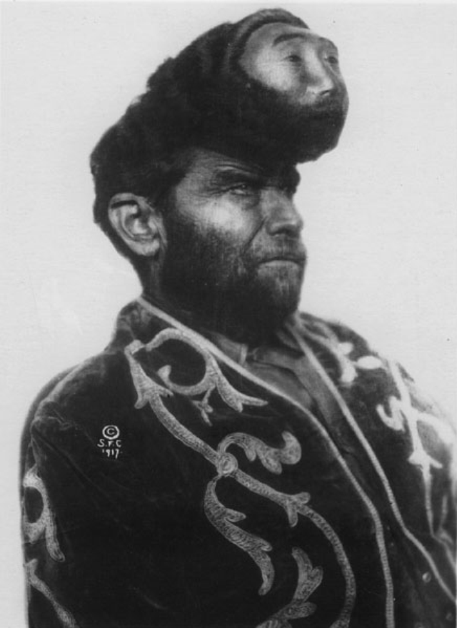 Tajemný Pasqual Pinon Narodil se skutečně jako dvouhlavý muž