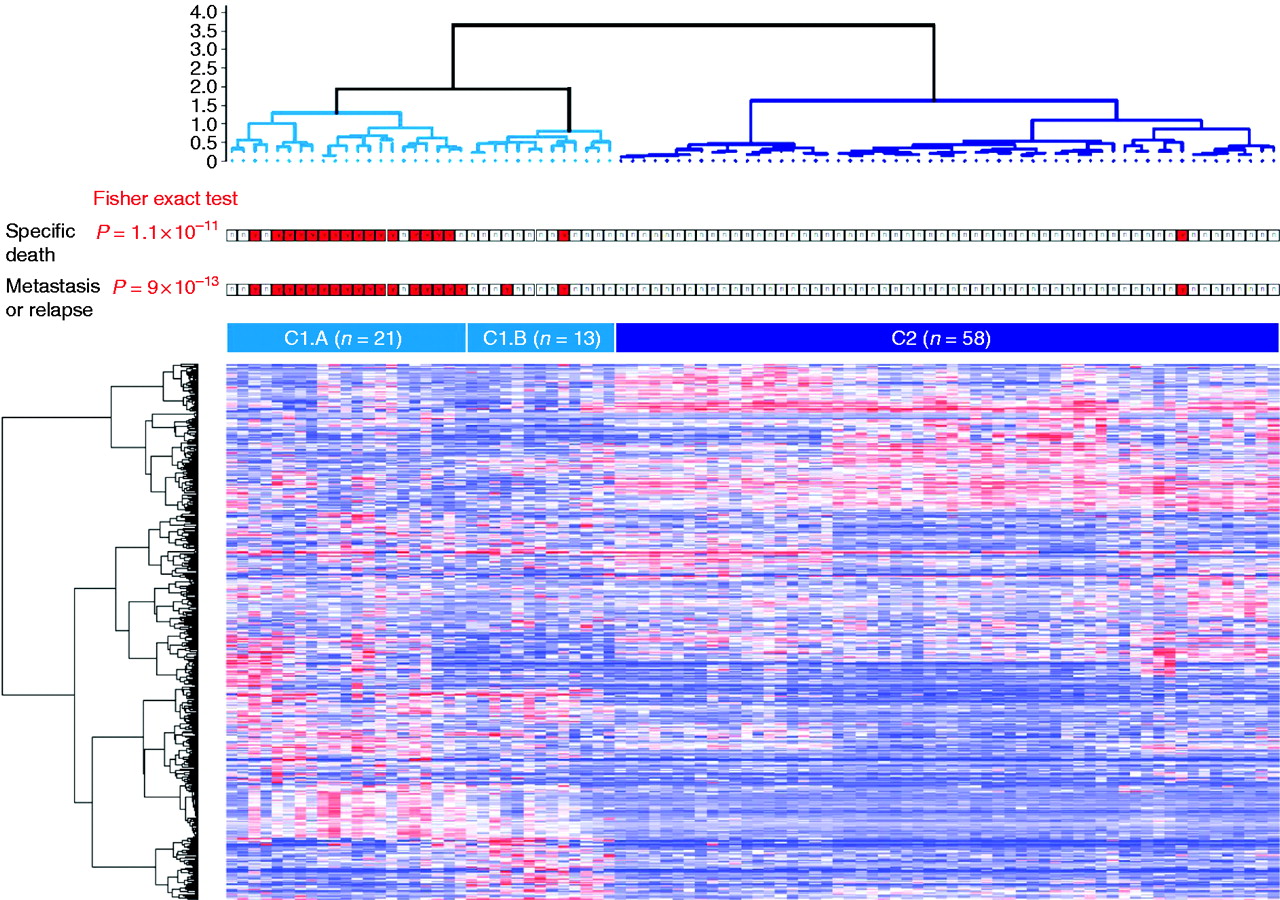 Transcriptome analysis of adrenocortical cancers from molecular