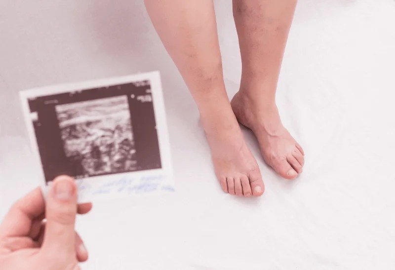 Are Recliners Bad For Leg Circulation? 8 Tips To Prevent