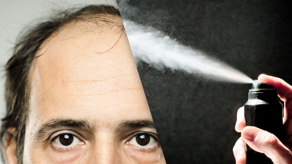 Can Dry Shampoo Cause Baldness? Erica Marr Films