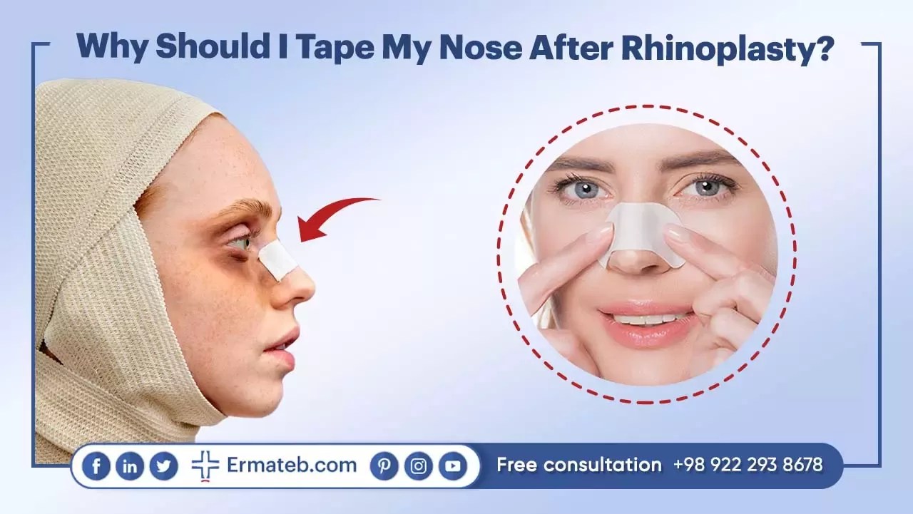 Taping Nose After Rhinoplasty AdvantageHow to do Ermateb