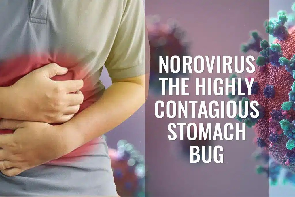 Norovirus The Highly Contagious Stomach Bug ER Of Watauga