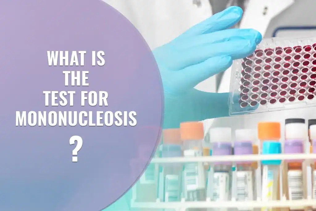 INFECTIOUS MONONUCLEOSIS UNMASKED A HOLISTIC APPROACH TO RECOVERY