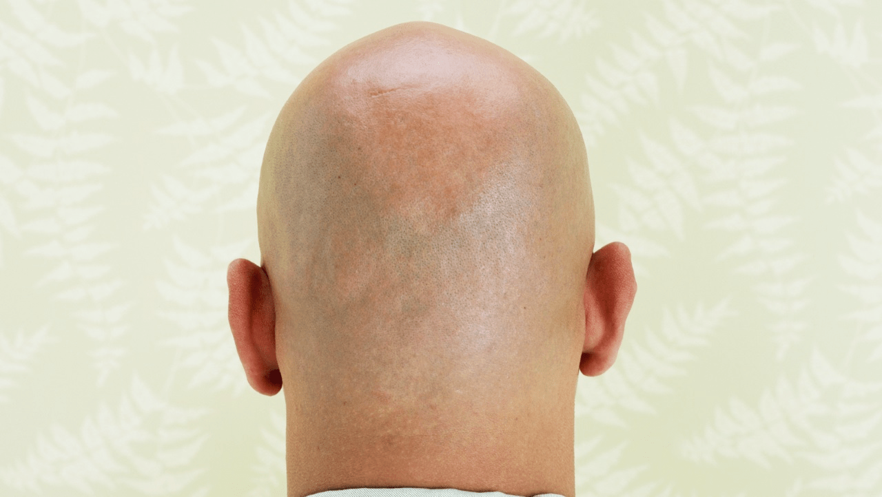 Research on perception of men with shaved heads Eslkevin's Blog