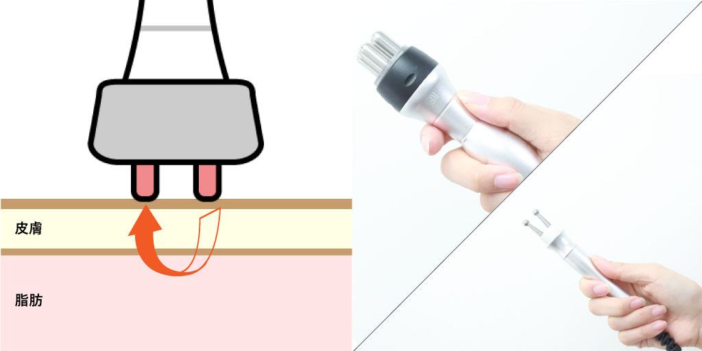 ラジオ波（RF）の説明 どのような痩身効果が ダイエット初心者向けに解説 エスプラ