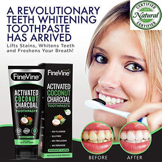 Best Teeth Whitening Products [TESTED] Buyers Guide