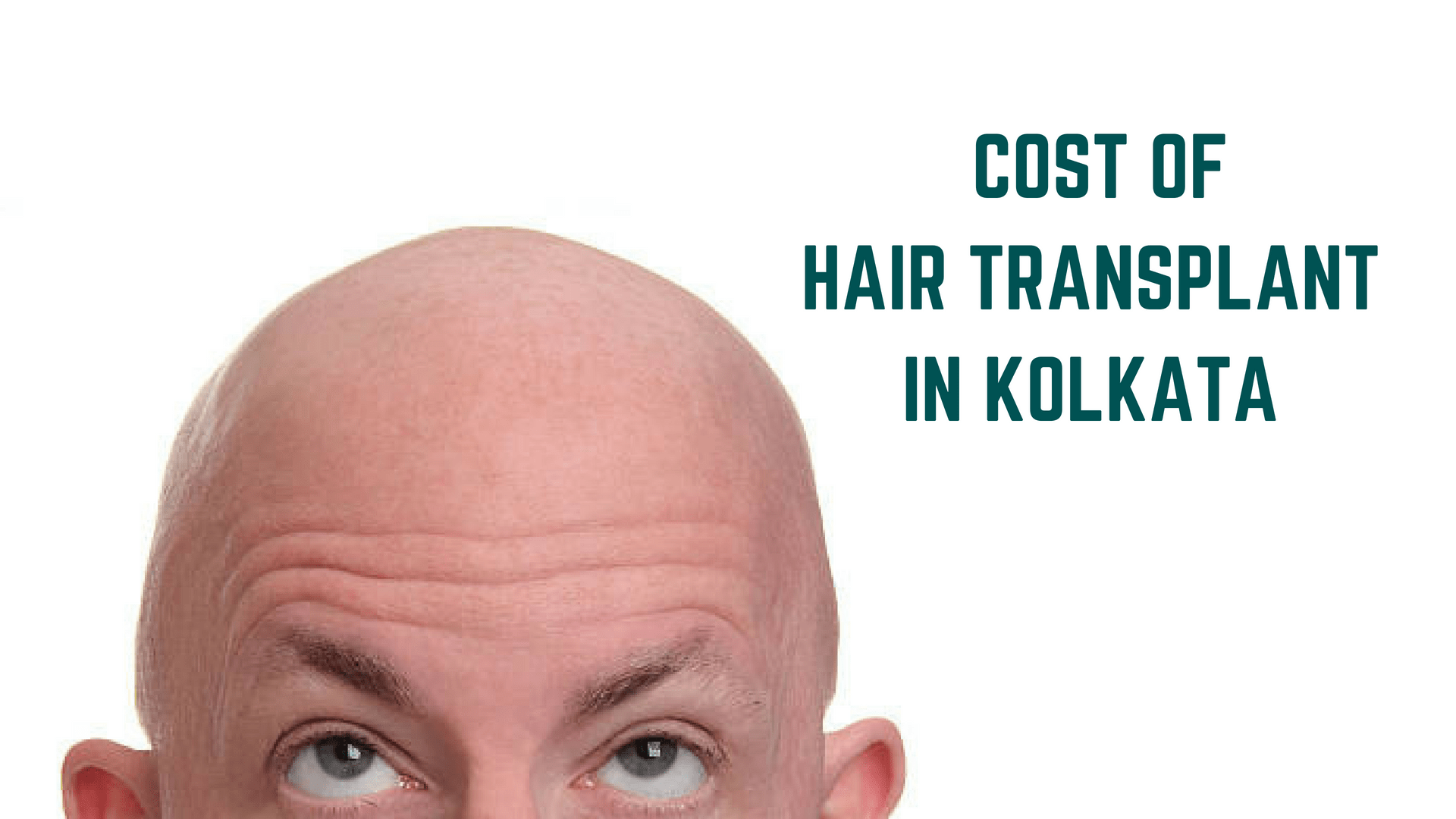 Hair Transplant Cost in Kolkata Essencz