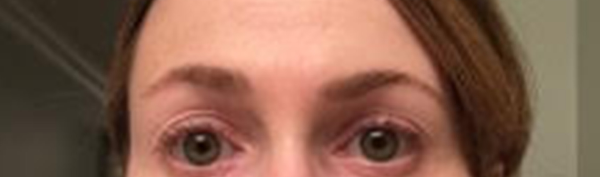 Chemo Patient Testimonials EES Essential Eyebrow Solution