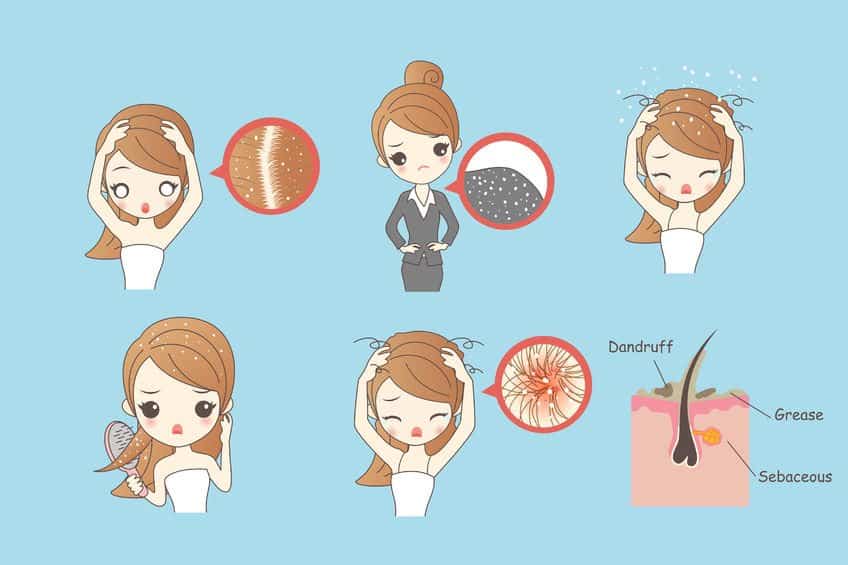 Can Dandruff And Itchy Scalp Be Cured Using Essential Oils