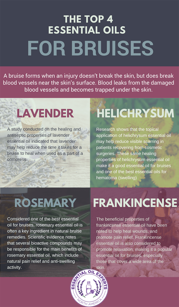 Top 4 Essential Oils for Bruises Home Remedies for Bruises