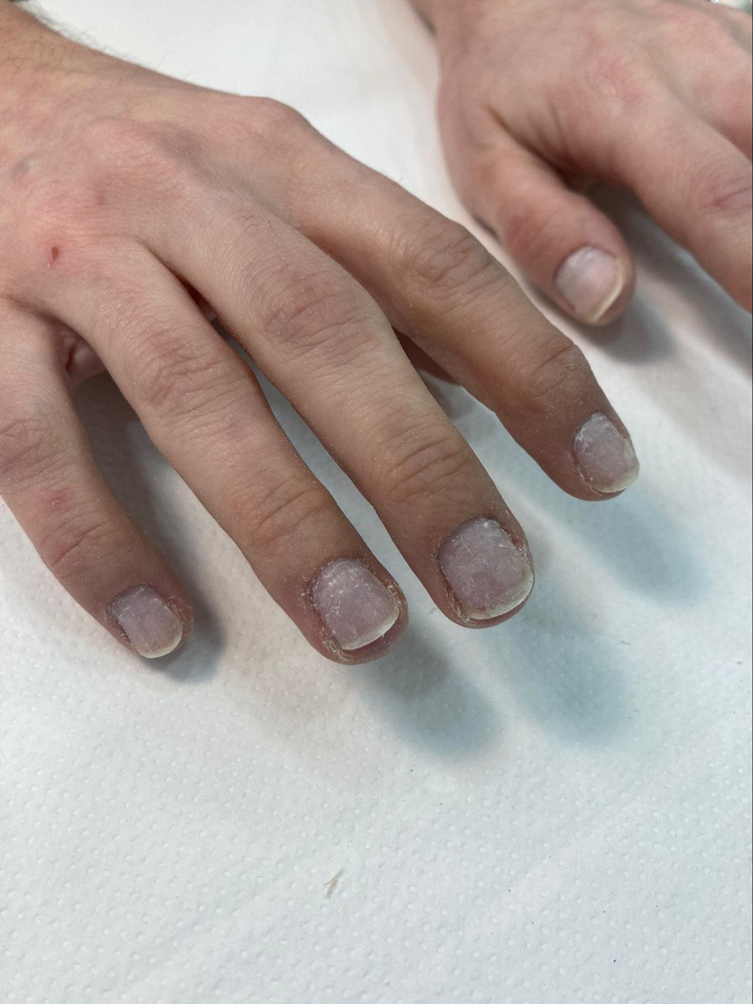 IBX nail treatment Estètic