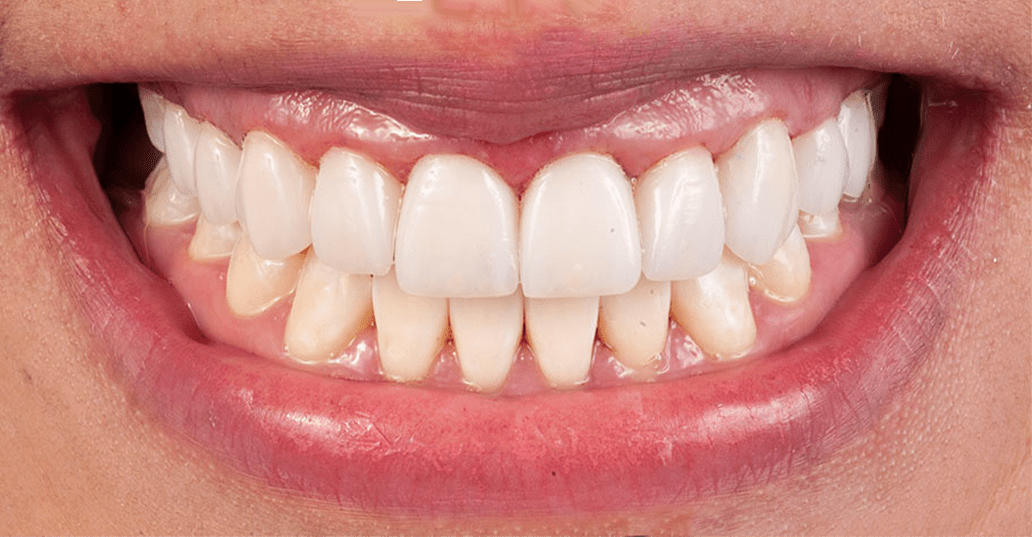 Dentistas Estéticos 1 en Querétaro Esthetic Dental Center