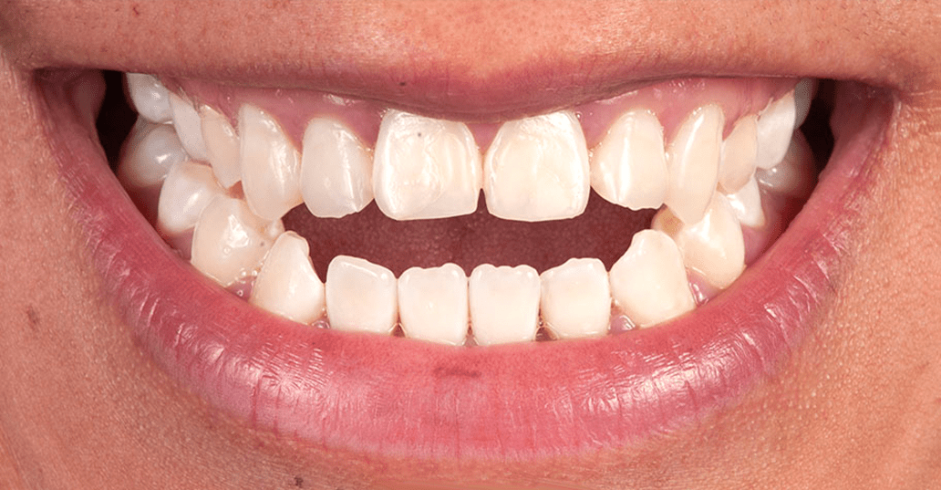 Dentistas Estéticos 1 en Querétaro Esthetic Dental Center