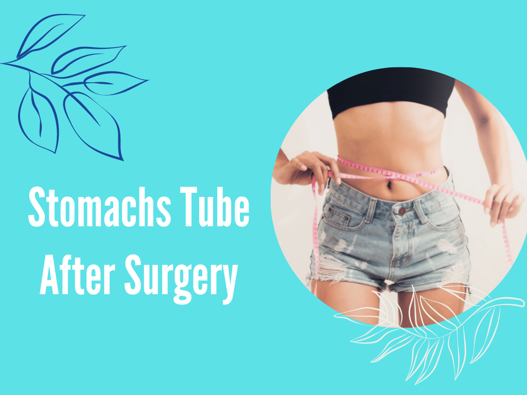 Recovery After Bariatric Surgery Estheticland