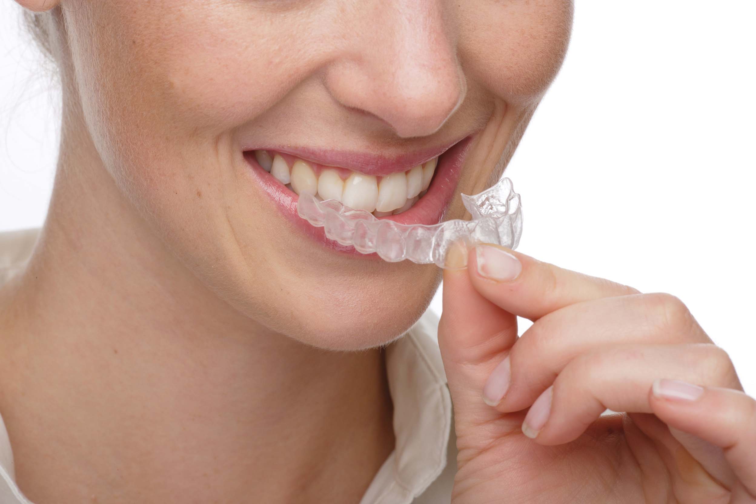 Invisalign Barcelona Estudi Dental Barcelona