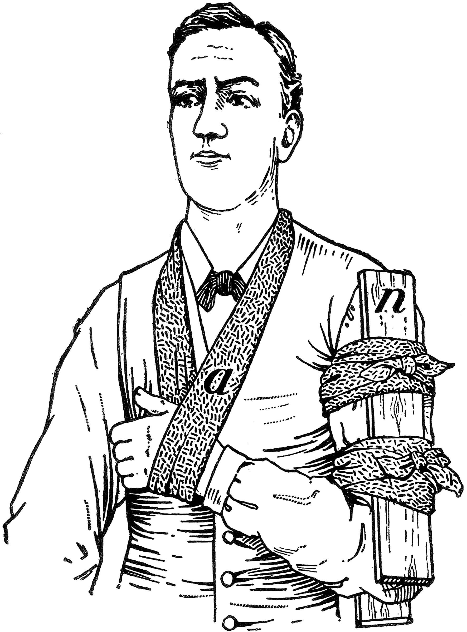 Splint ClipArt ETC