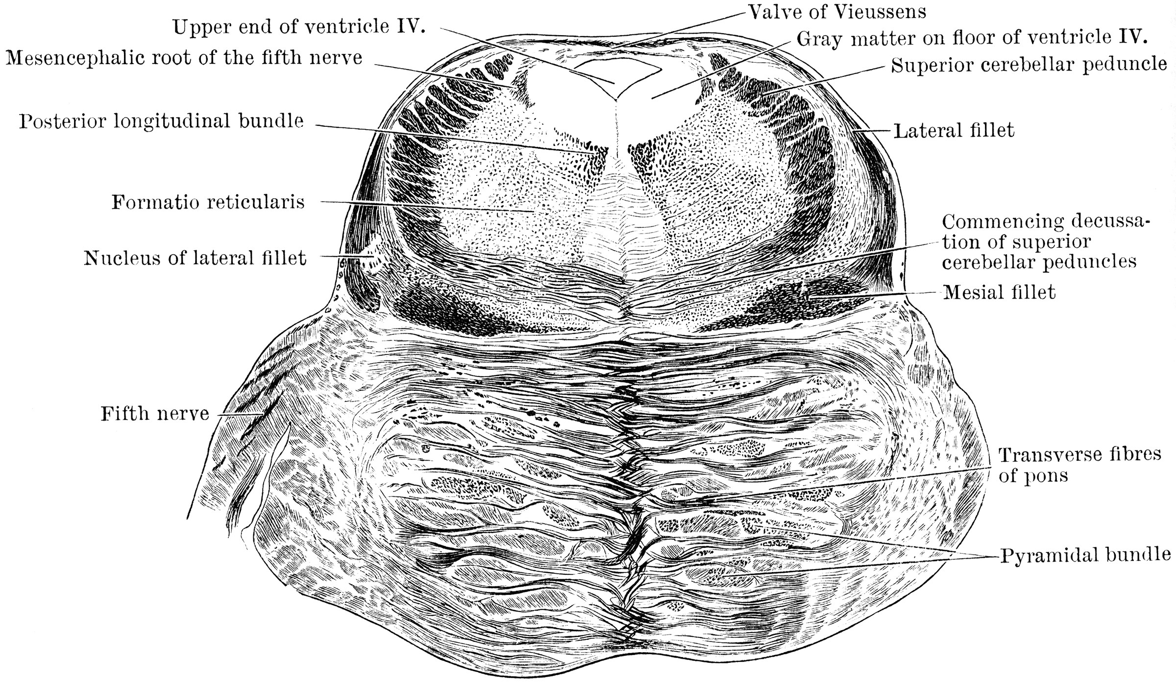 Section Through Pons Varolii ClipArt ETC