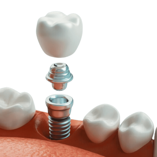 Can You Safely Undergo an MRI with Dental Implants? ETCN