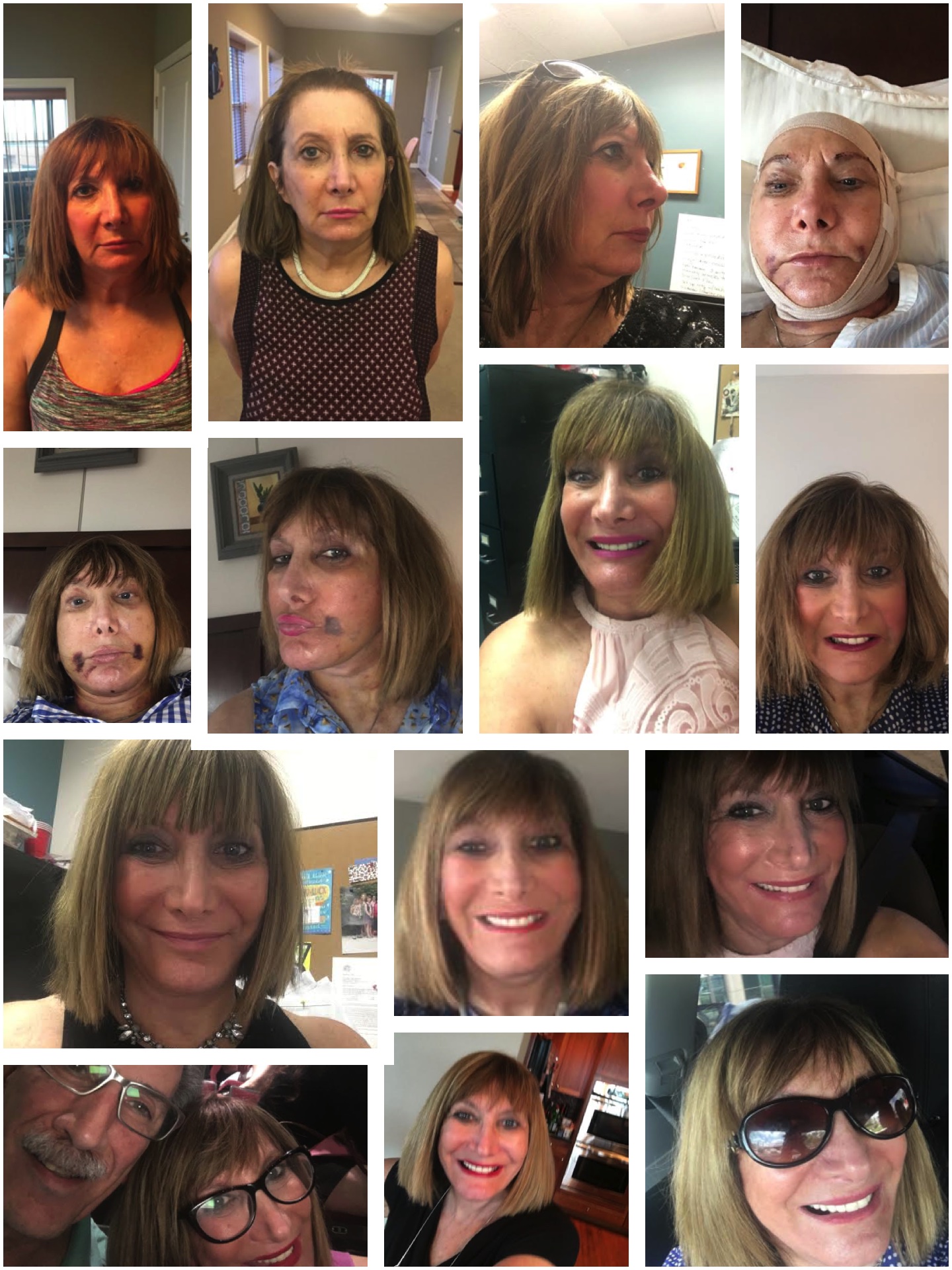 Alexa Plastic Surgery in Costa Rica