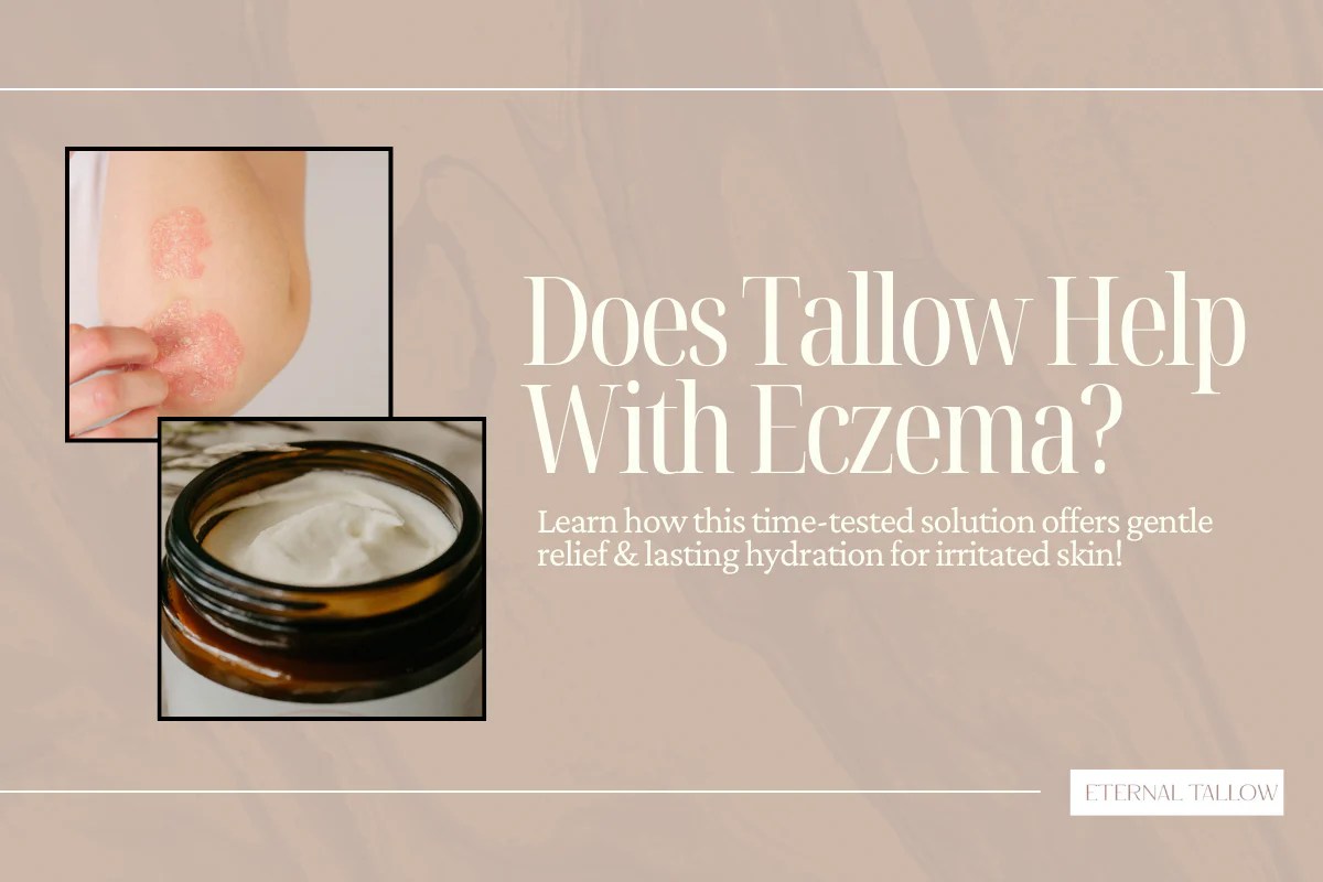 Is Beef Tallow Good For Eczema? Winnipeg Eternal Tallow