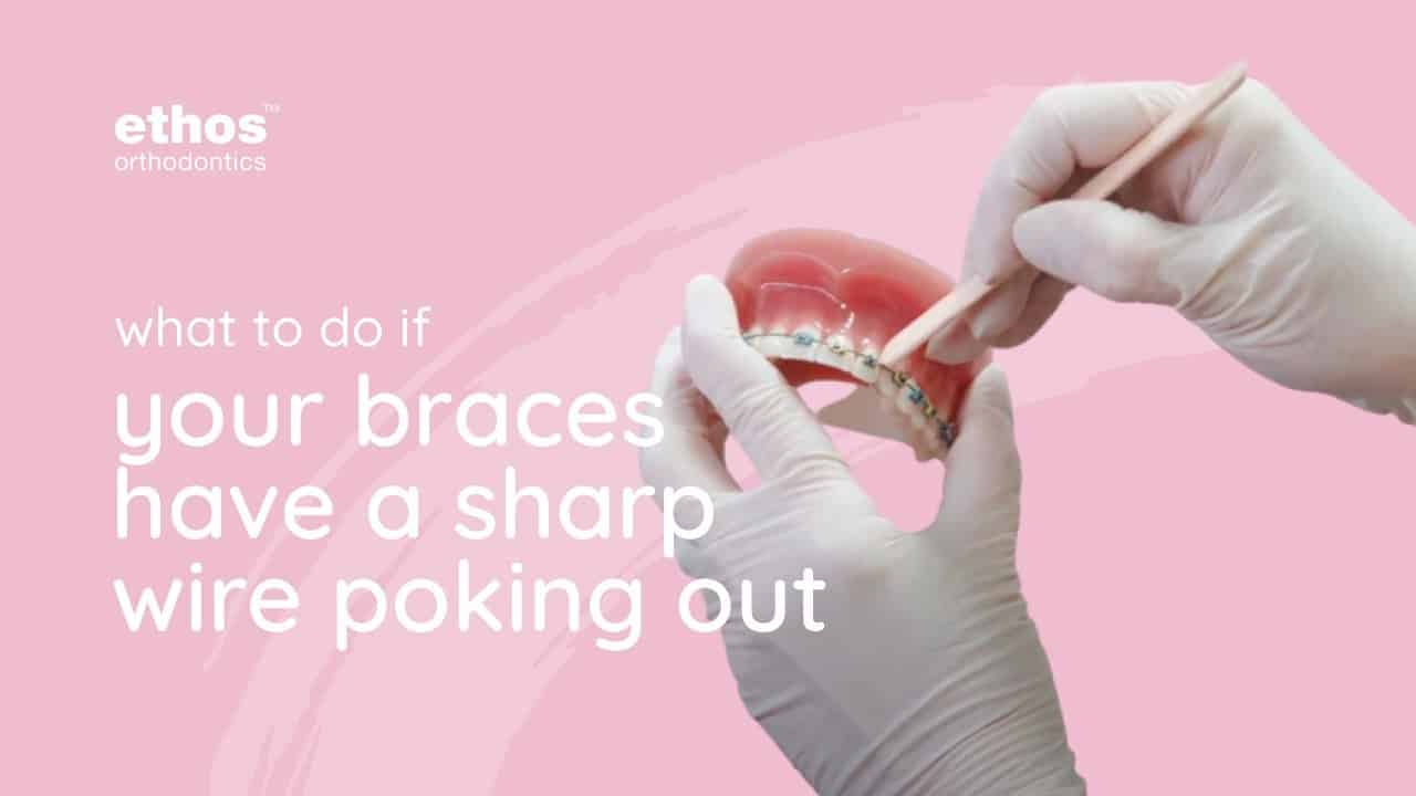 What To Do If You Have A Sharp Braces Wire Ethos Orthodontics