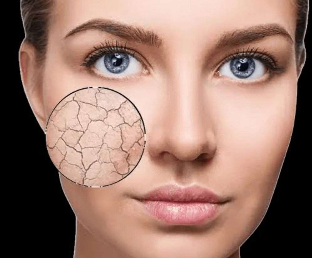 What’s the difference between ‘dry skin’ and ‘dehydrated skin’? Eudelo