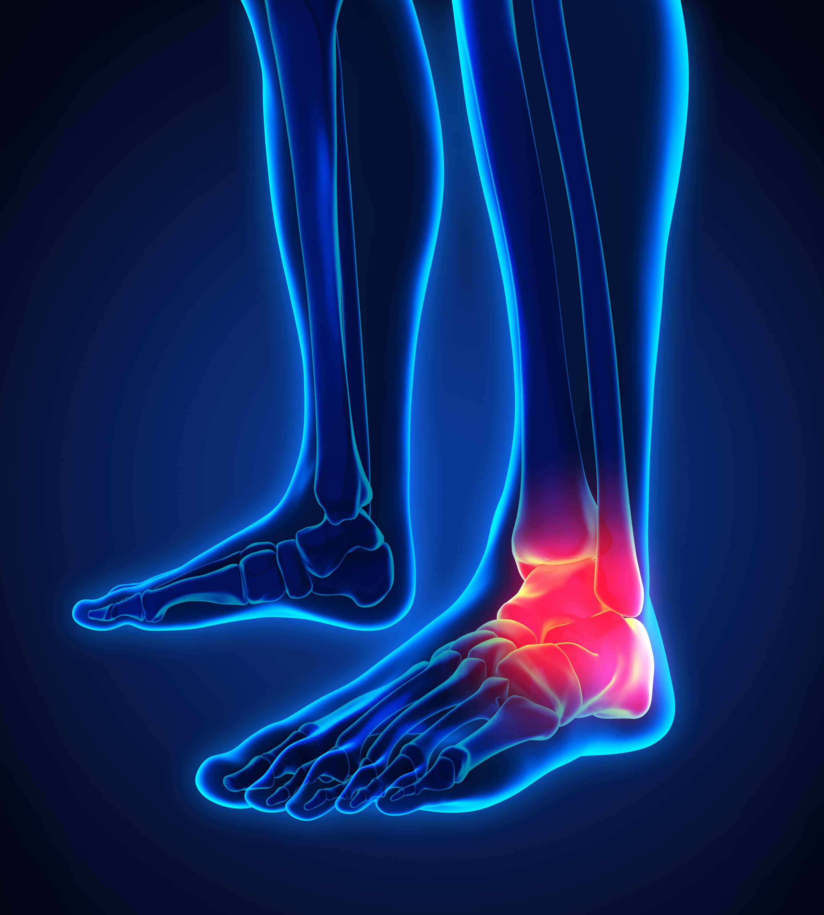 Advanced Treatments for Chronic Pain Eugene Foot and