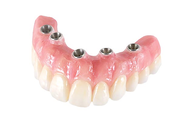 Low Cost Full Dentures from 698 ID, OR, WA