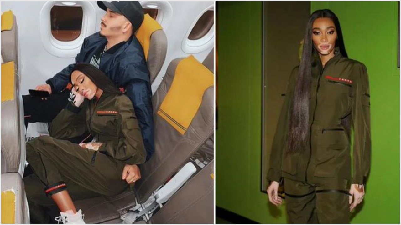 Model Winnie Harlow Claps Back at Critics After Complaining About