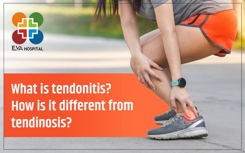 What is Tendonitis? How is it Different from Tendinosis? Eva Hospital