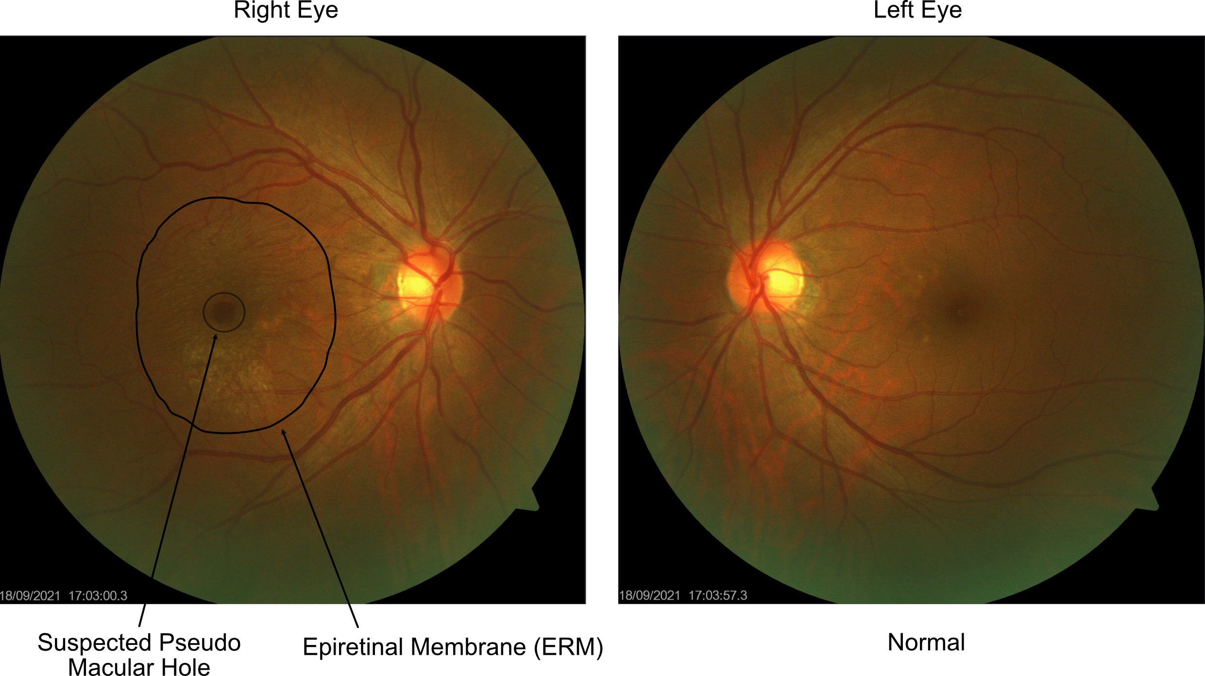 Eye Exam VS Eye Test Which are you getting? Evershine Optical