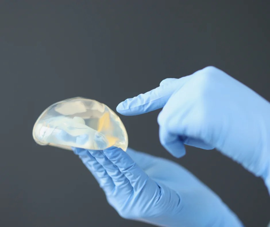 Can you breastfeed after getting breast implants? Evidence Based Babies