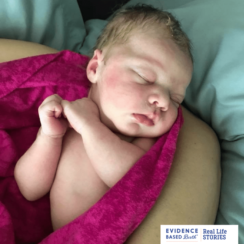 Real Life Stories Eye Ointment Evidence Based Birth®