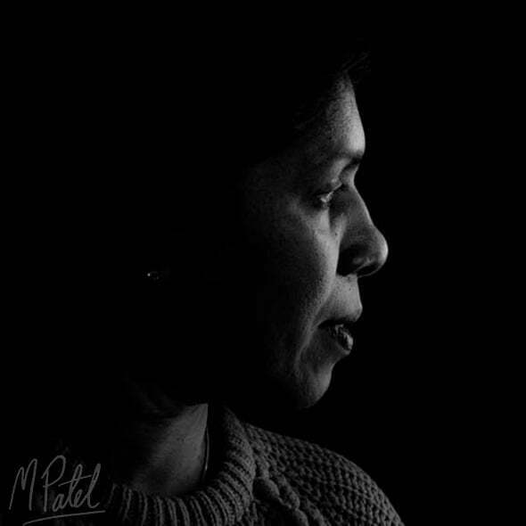 Evolution Orthodontics FIRST Impressions Braces Gants Hill Dr Patel