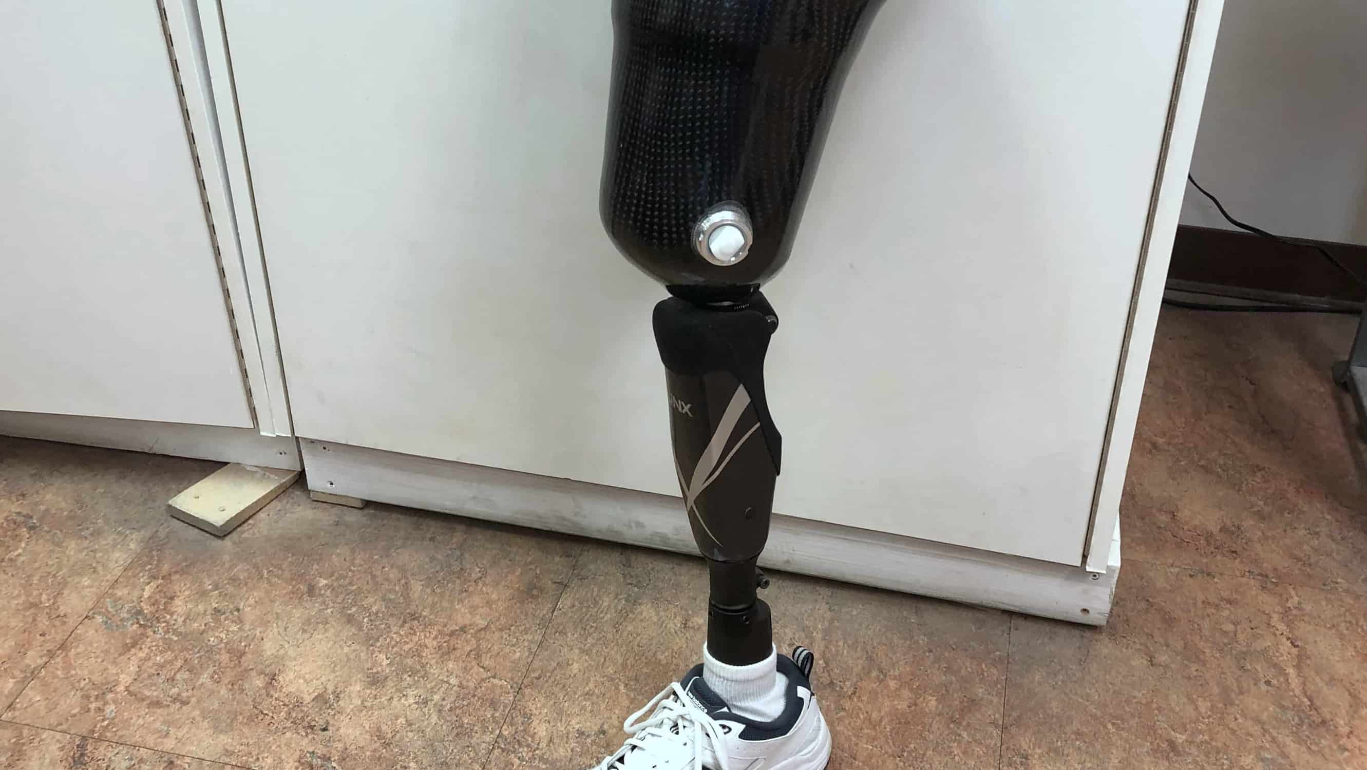 Prosthetic Knee Vegas Evolve Prosthetics & Orthotics