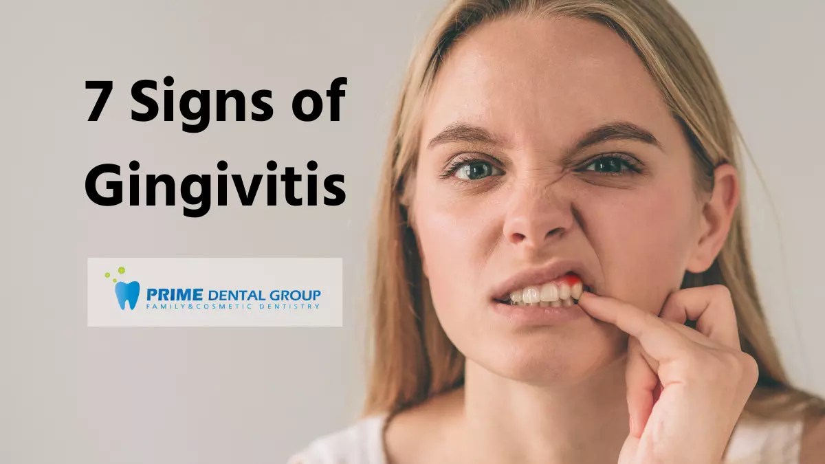 7 Signs of Gingivitis Treatment (2024) Prime Dental Group