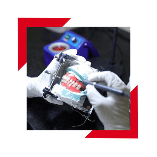 The Best Dental lab for Affordable and Professional Services Eway Dental Lab