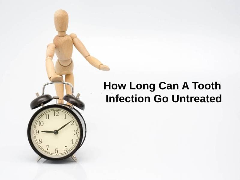 How Long Can A Tooth Infection Go Untreated (And Why)?