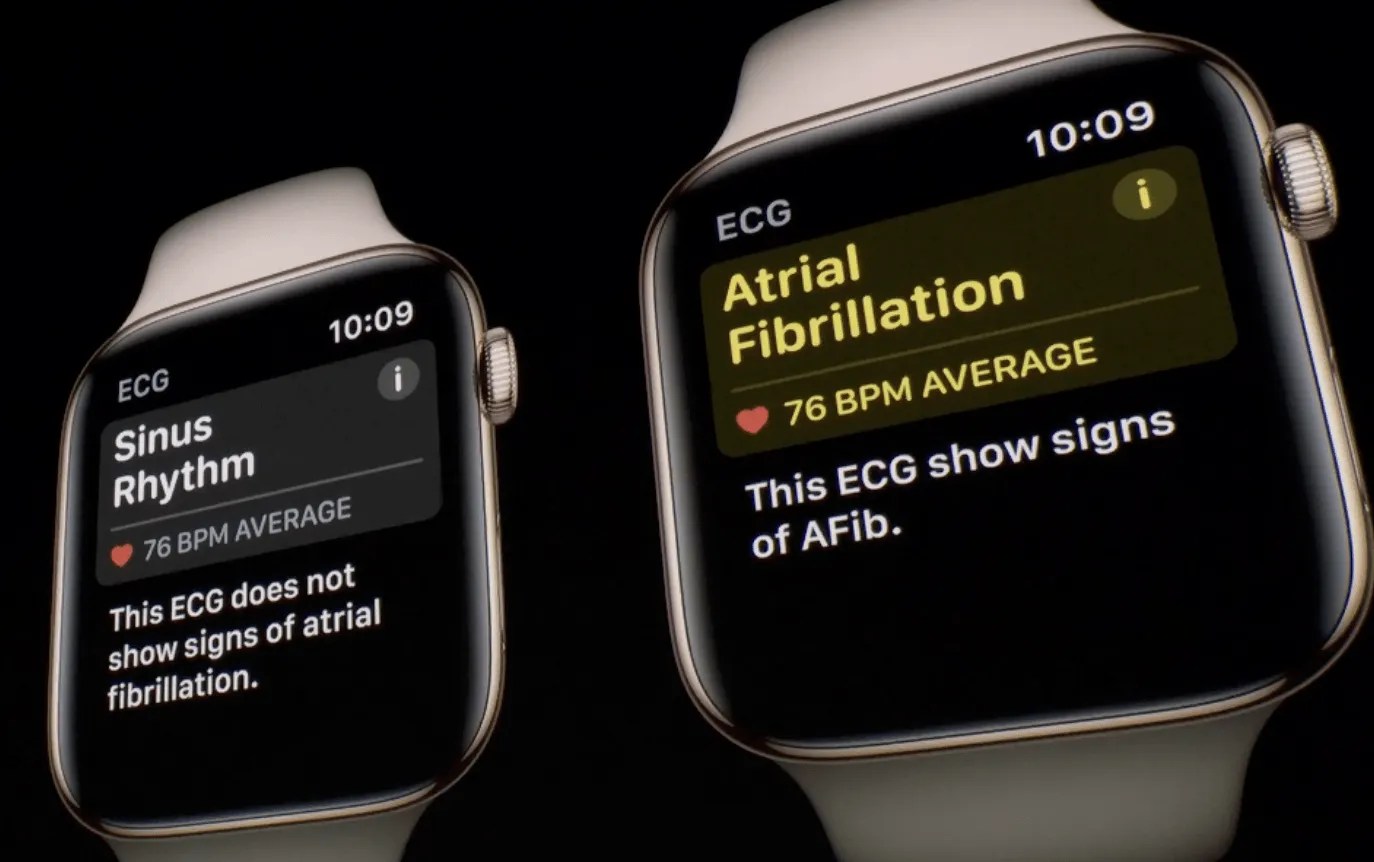 Can Apple Watch Measure Blood Pressure? Here's What You, 50 OFF