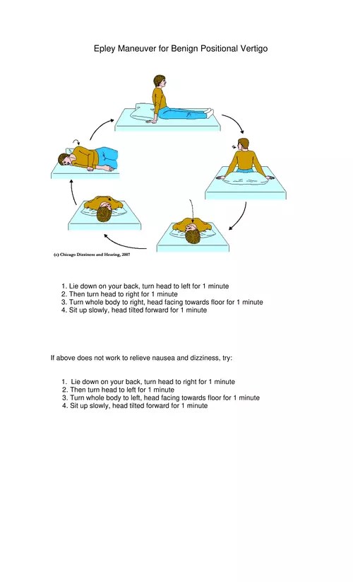 Exercises Epley Maneuver for Benign Positional Vertigo Mount Sinai