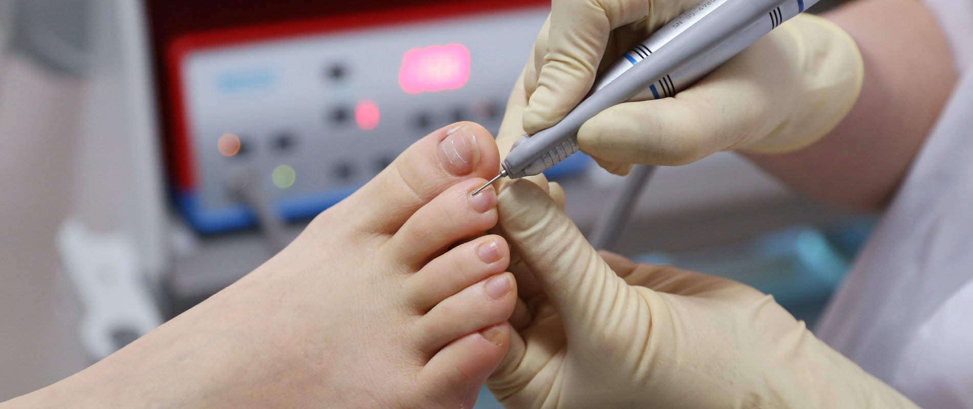 Podiatry Exl Physiotherapy & Sports Rehab Carlingford