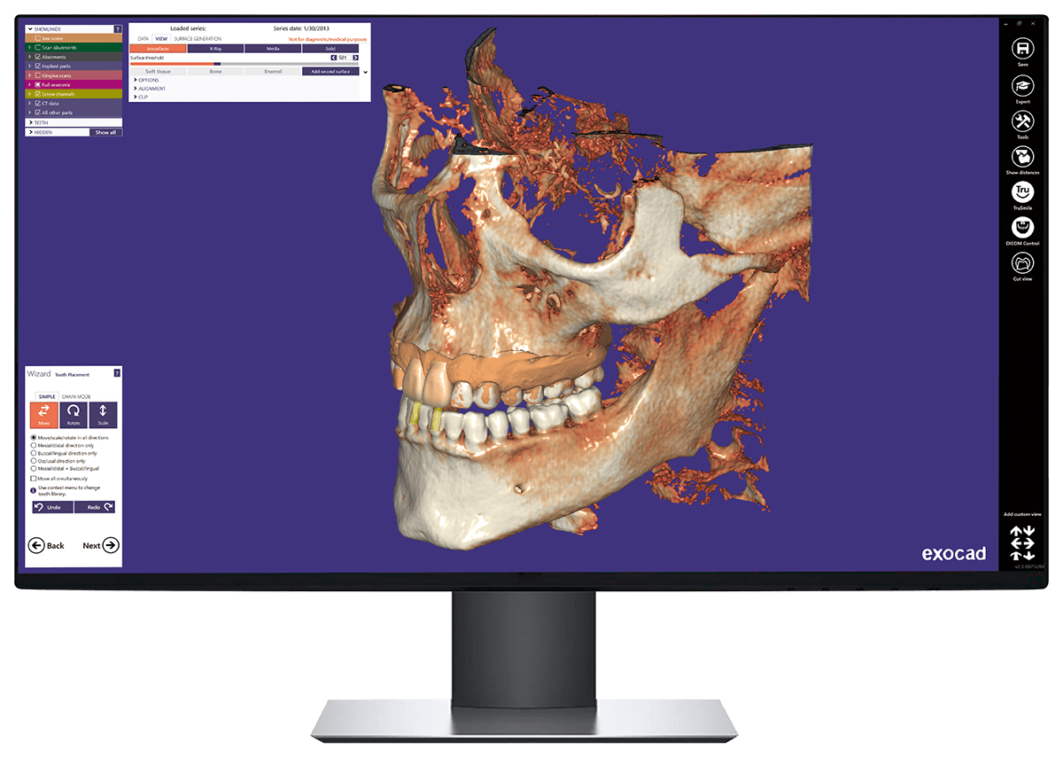 Cd viewer. Dicom viewer 3d. dcm dicom. виртуальный артикулятор exocad.