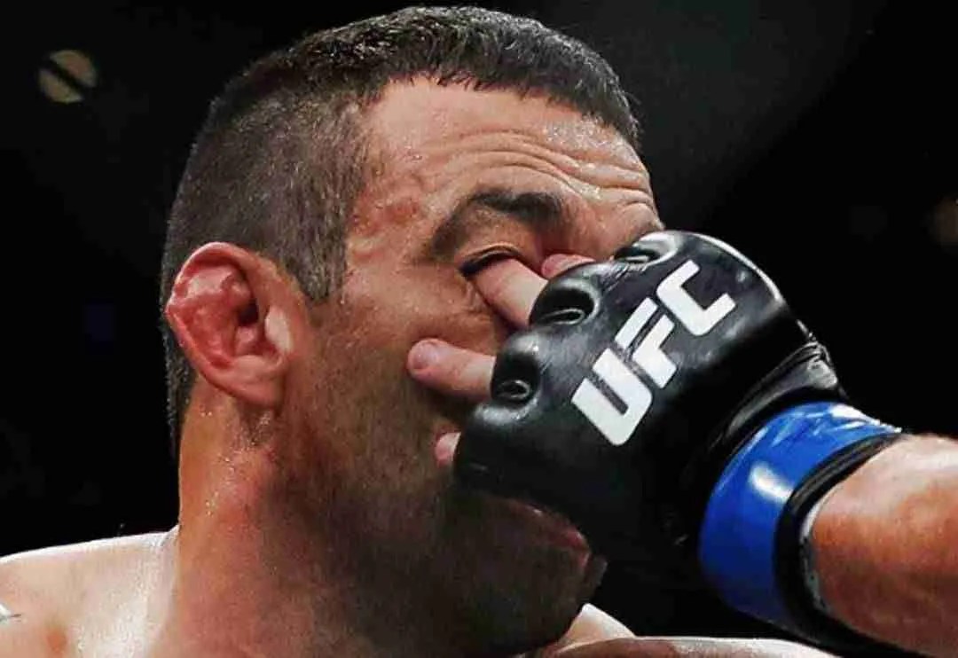 The Finger Jab in the Eyes Fighting Tips Street Fight Mentality