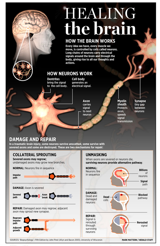 Healing the Brain // Explica Media