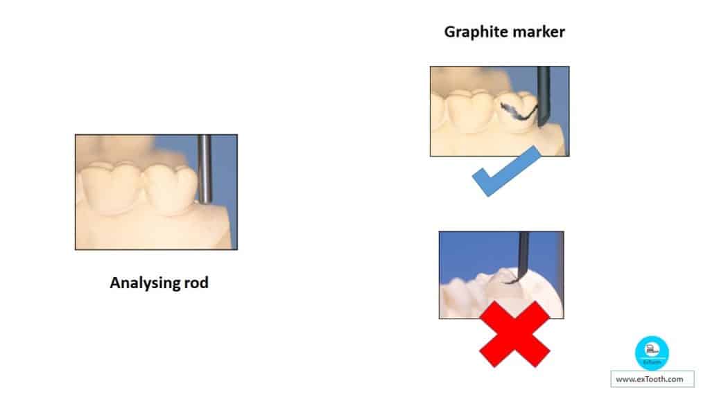 Dental Surveyor and learn the steps of surveying! extooth