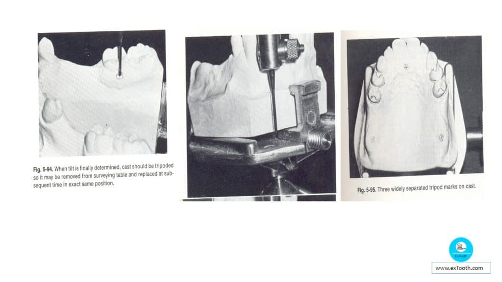 Dental Surveyor and learn the steps of surveying! extooth