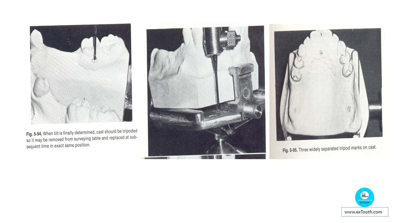 Dental Surveyor and learn the steps of surveying! extooth