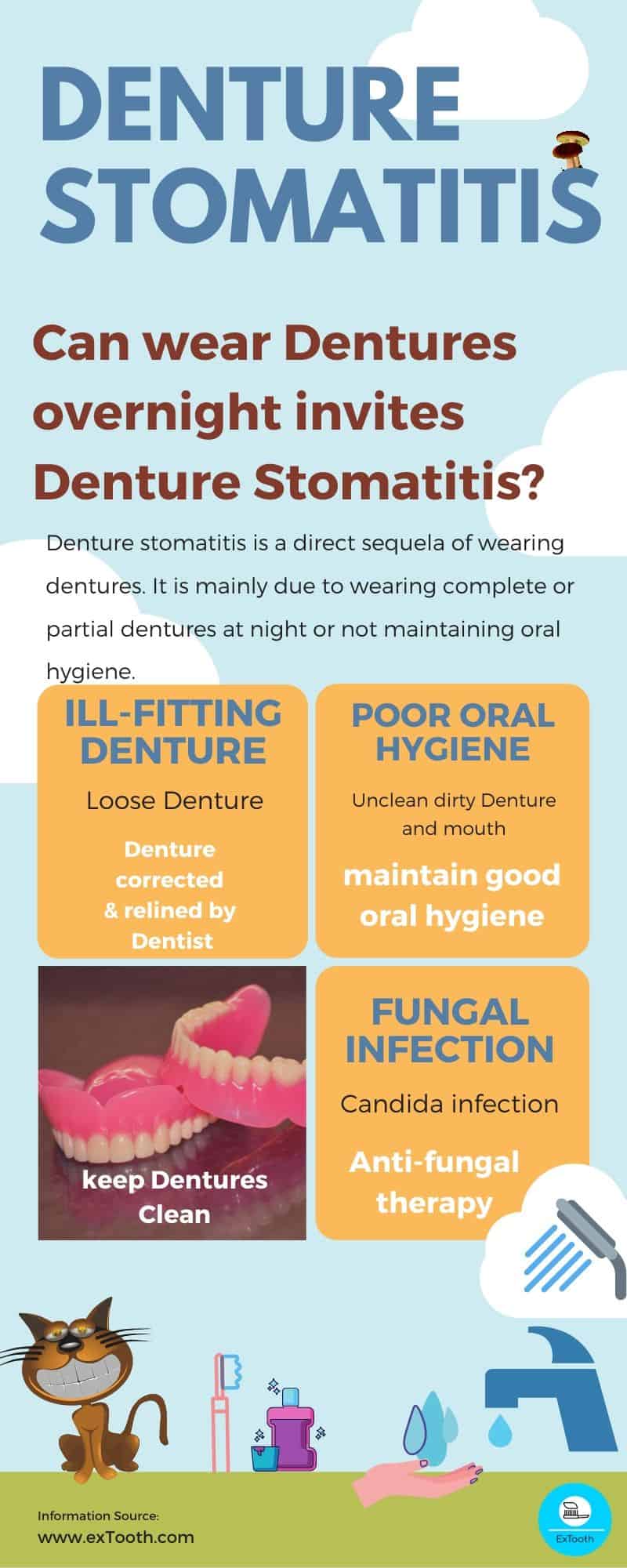 Can wear Dentures overnight invites Denture Stomatitis? extooth